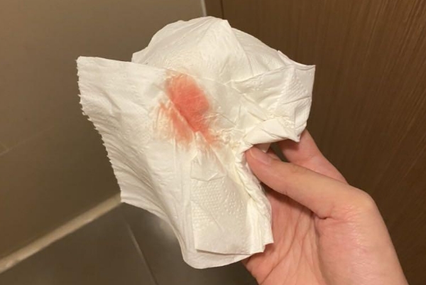 胚胎着床出血时间不长
