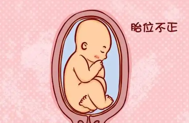 正常胎位先入盆的为胎头