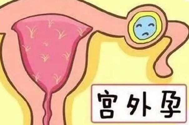 通过试管婴儿技术将胚胎移植体内发生宫外孕几率大吗？