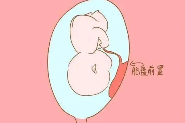为什么男宝喜欢依附在子宫前壁呢?