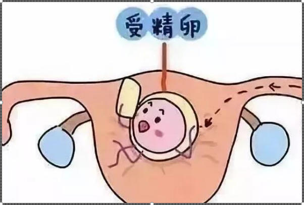 试管婴儿胚胎移植后几天会顺利着床呢?有哪些影响成功因素呢?