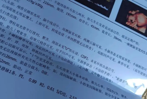 四维上的qualhigh1无法判断是男是女