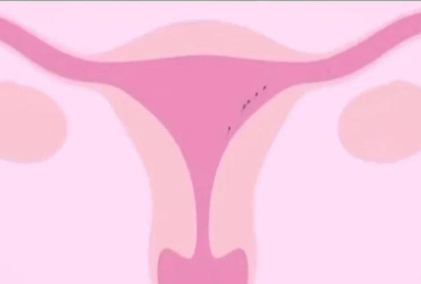 胚胎移植手术后要适当休息