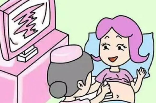 顺产评估要做很多检查