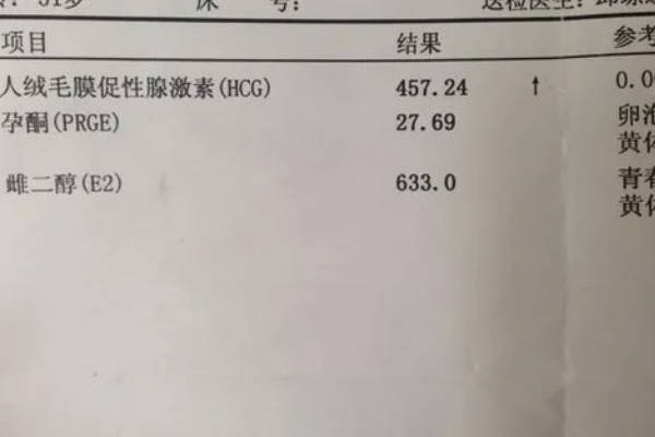 hcg其实就是人绒毛膜促性腺激素