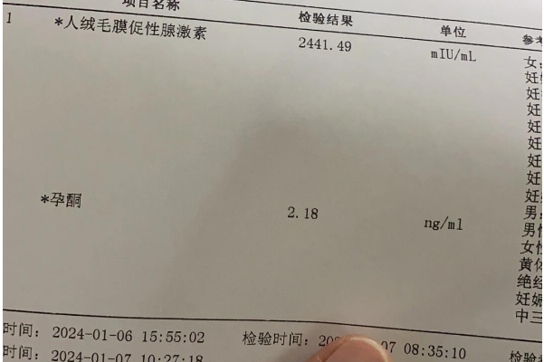 胚胎移植孕酮多少最佳，一文教你科学把控黄金指标