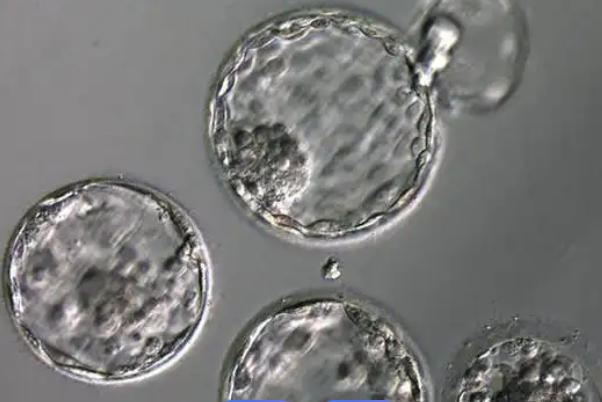 囊胚等级越高质量越好