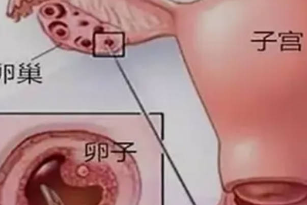取卵手术第五天后有淤血块流出像来月经一样是什么原因？