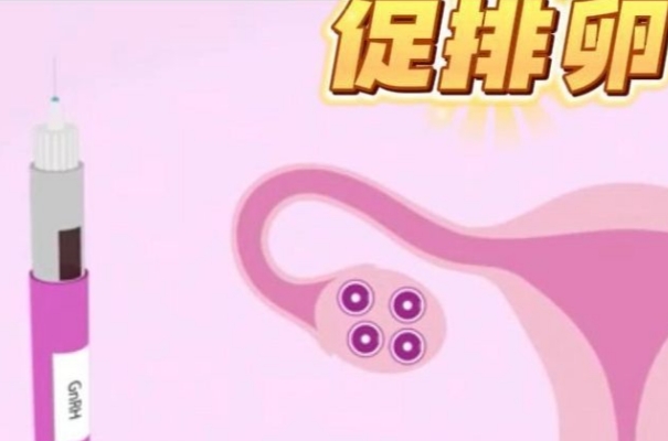 克罗米芬是促排卵药物
