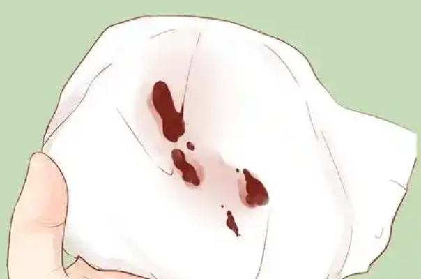 胚胎着床成功会有轻微出血
