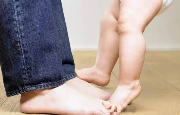 宝宝无法下蹲可能是脑瘫