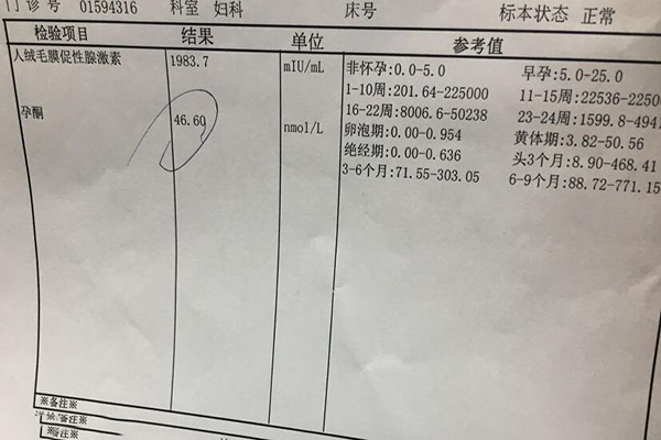 hcg倍增宫外孕可能性很大