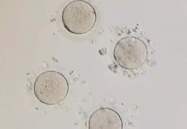 试管卵泡多大才算成熟优势卵泡呢？通常直径在18mm左右