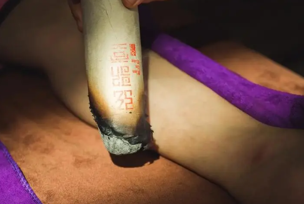 医生说这8种人千万不能艾灸，醉酒者、皮炎患者只是其二