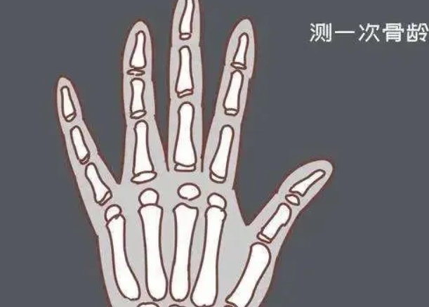 孩子骨龄闭合后跳绳居然又长高了，这正常吗？