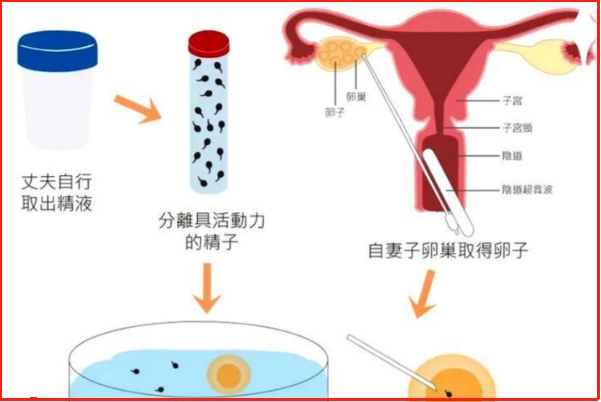 试管移植如果不能自然周期怎么办？别担心这里有解决方案！