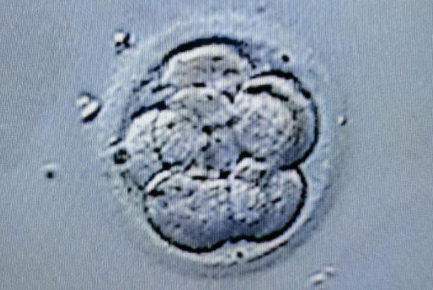 试管移植胚胎的数量因人而异