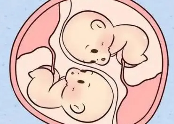 自然受孕怀双胎几率小