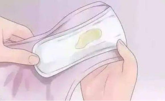 雌激素高阴道分泌物会增多