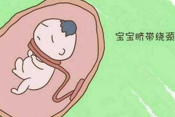 胎儿脐带绕颈会造成频繁胎动