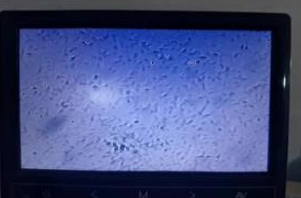 一次冻精可做几次试管婴儿？冻精使用次数与试管成功率解析