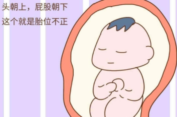 胎位不正要注意哪些，产检、睡姿等都要关注