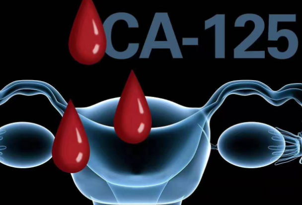 CA125属于血液检查范畴