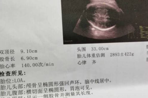 b超单子上面孕囊数值可判断男女