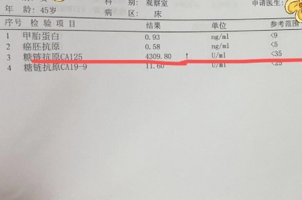 检查CA125有利于提高备孕效率