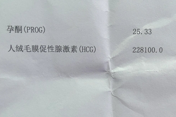只要hcg在涨就没胎停，实施情况并非如此