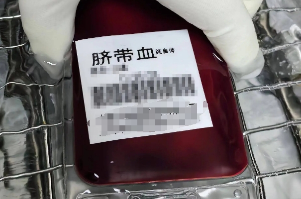 为什么专家建议不要存脐带血，治疗范围狭窄成本高
