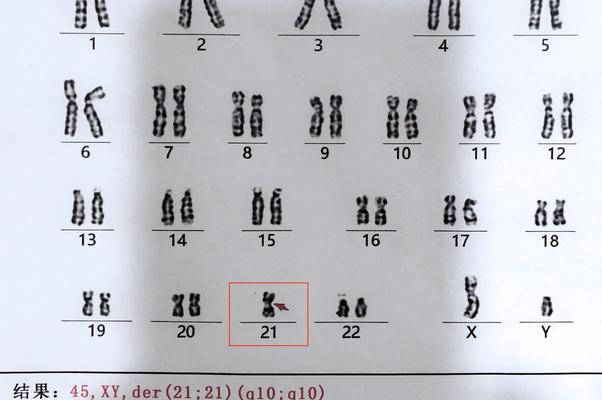 男女双方应该检查一下染色体情况