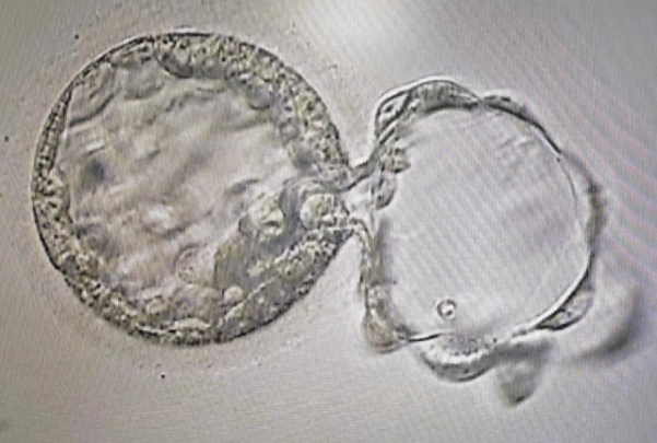二代试管要多少级别的胚胎才可以冷冻保存？