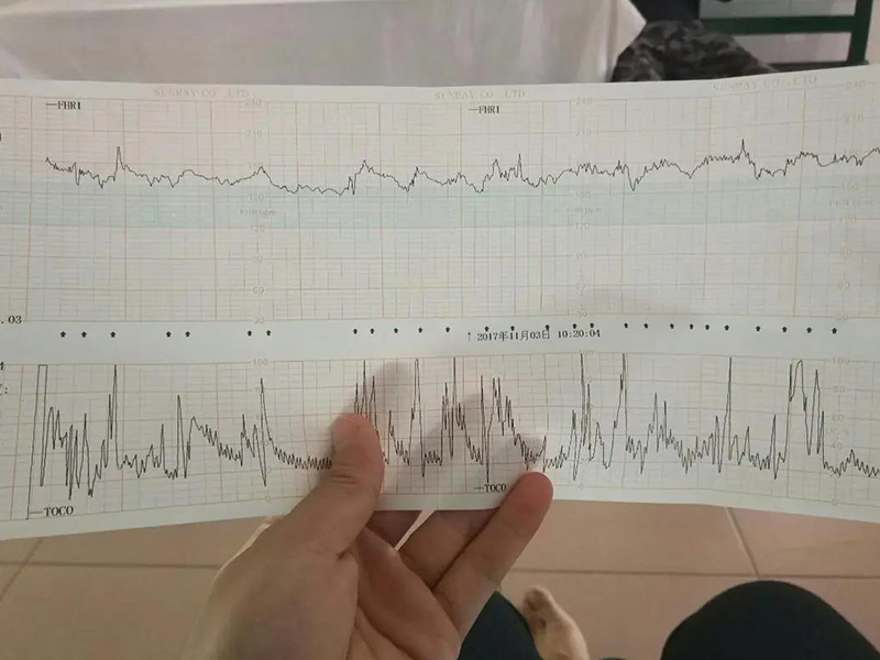 都说孕晚期胎心率能看男女，那它们的对照表是怎样的呢？