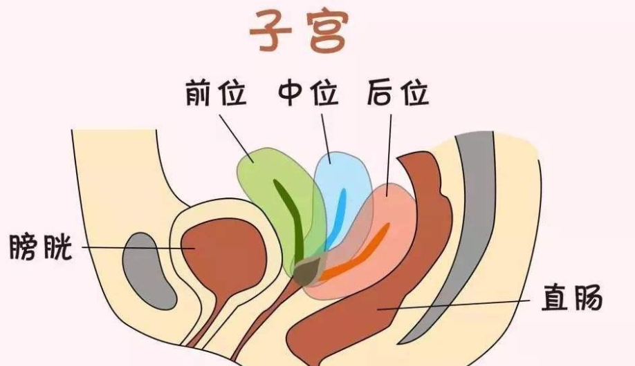 子宫后位最佳受孕方法图解，姿势选择是至关重要的存在
