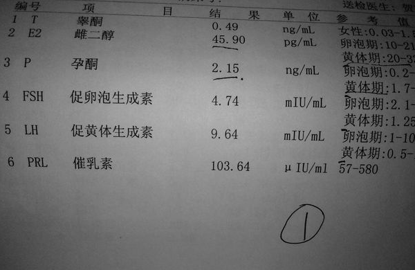 性激素六项不正常的危害汇总，月经失调甚至不孕要当心