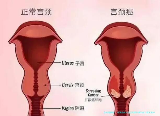 试管移植后可以吃维生素D3吗？维生素D3的其他益处介绍