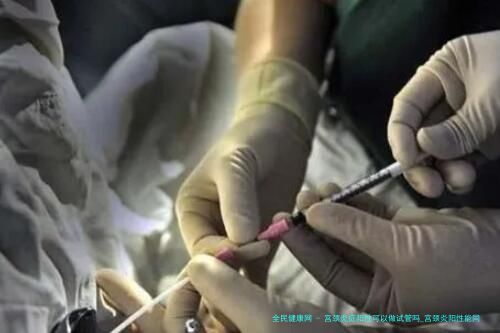 宫颈炎症阳性可以做试管吗_宫颈炎阳性能同房吗！