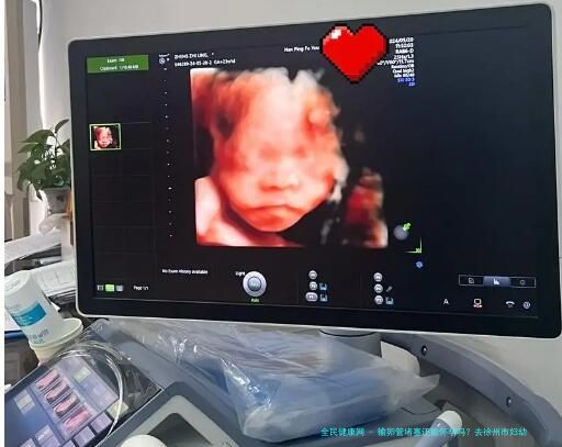 输卵管堵塞还能怀孕吗？去徐州市妇幼         做试管婴儿能成功怀上吗？