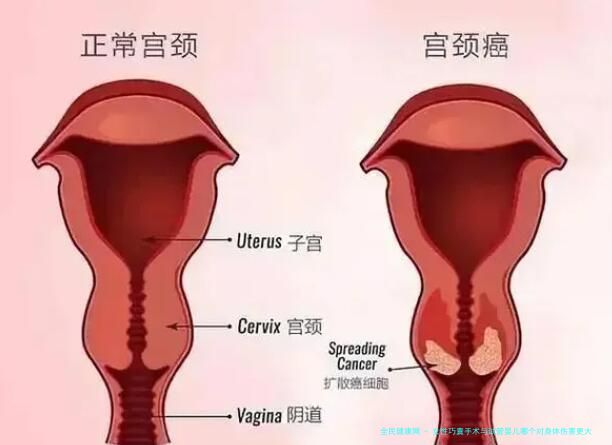 女性巧囊手术与试管婴儿哪个对身体伤害更大？比较手术风险分析