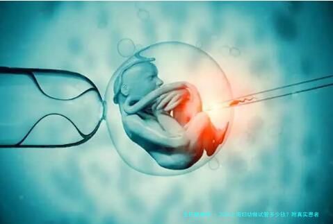 2025上海妇幼做试管多少钱？附真实患者就医费用经验交流