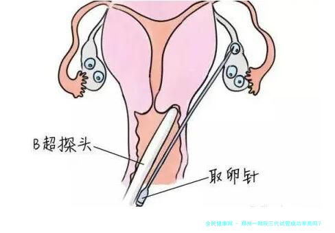 郑州一附院三代试管成功率高吗？