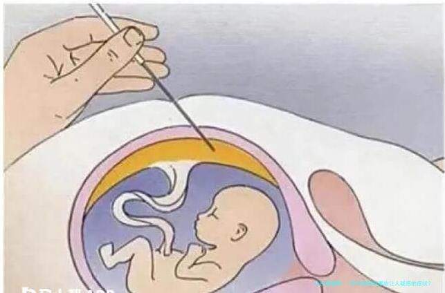 怀孕初期有哪些让人疑惑的症状？