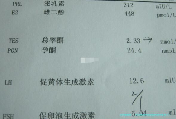 怀孕期间同房适宜的频率是多少？
