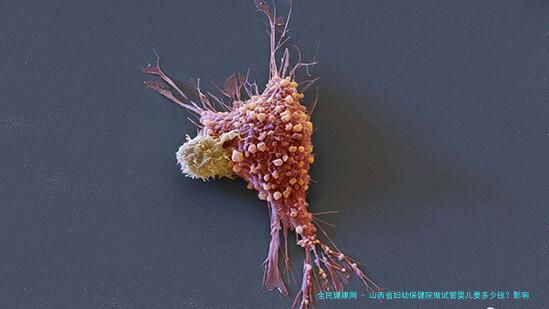 山西省妇幼保健院做试管婴儿要多少钱？影响试管价格因素有哪些？子宫内膜息肉是什么原因导致的？