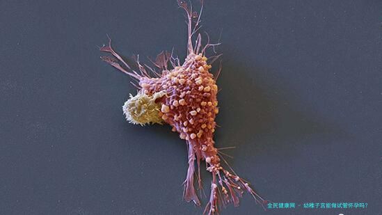 幼稚子宫能做试管怀孕吗？
