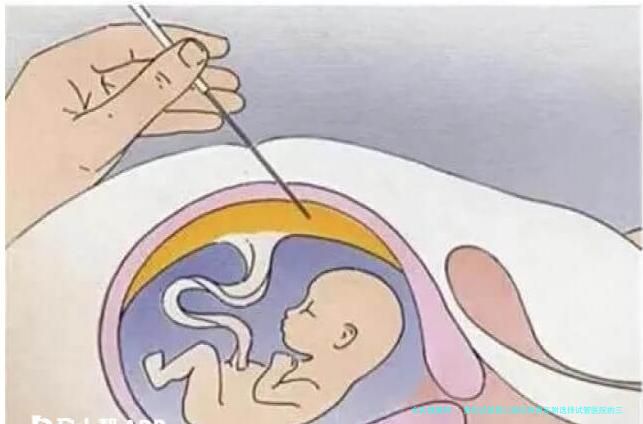 贵阳试管婴儿医院有很多附选择试管医院的三种方式！贵阳哪个医院可以做试管婴儿多少钱左右?！