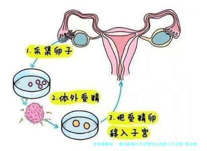 青岛做第几代试管可以选择三代试管(青岛做第几代试管可以选择三代试管吗)