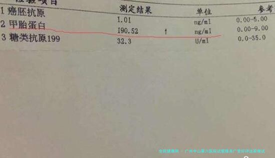 广州中山第六医院试管服务广受好评这家做试管贵吗