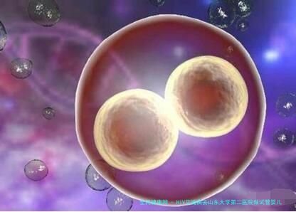 HIV艾滋病去山东大学第二医院做试管婴儿要多少钱